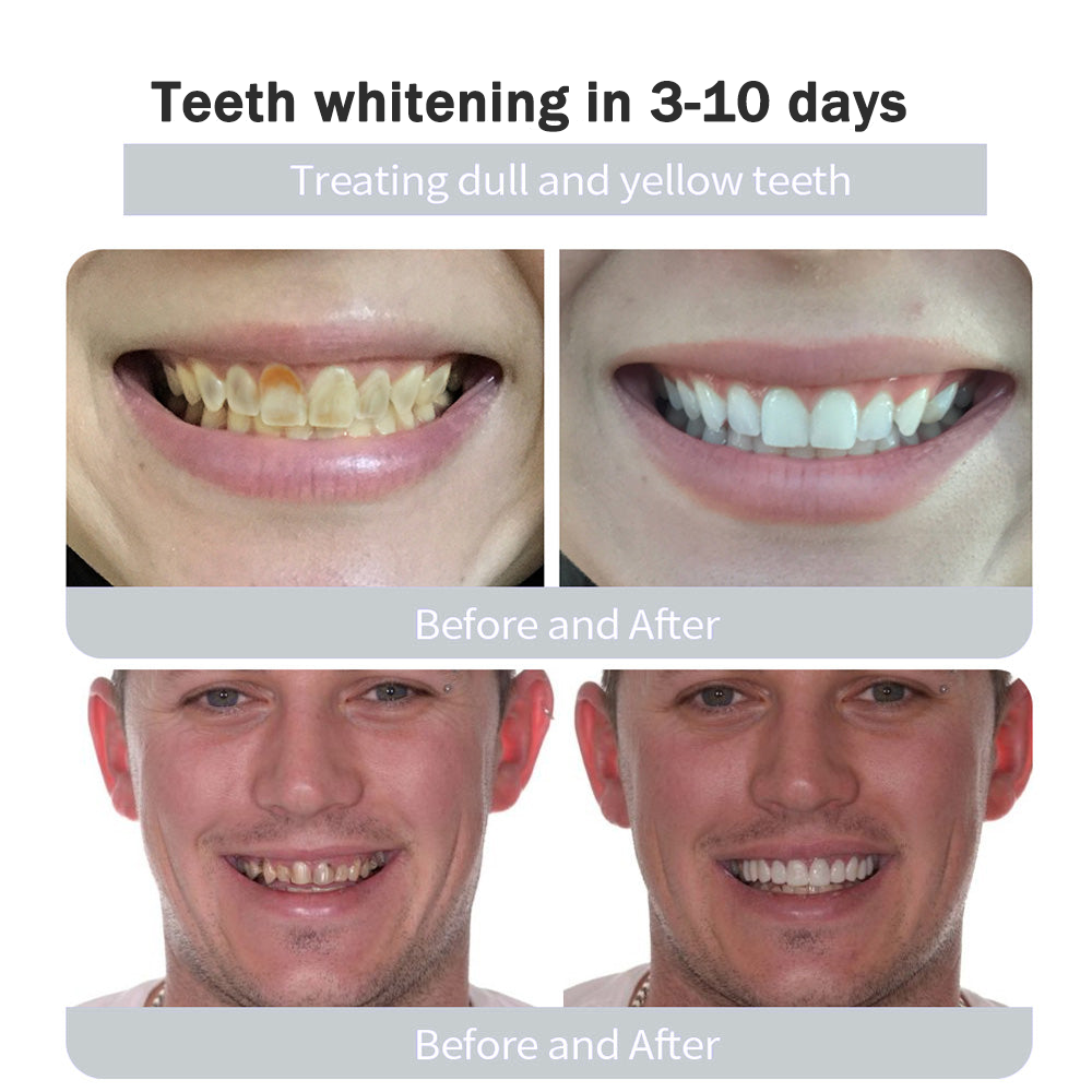 Natravor™Remineralizing & Whitening Tooth Powder Cool Mint