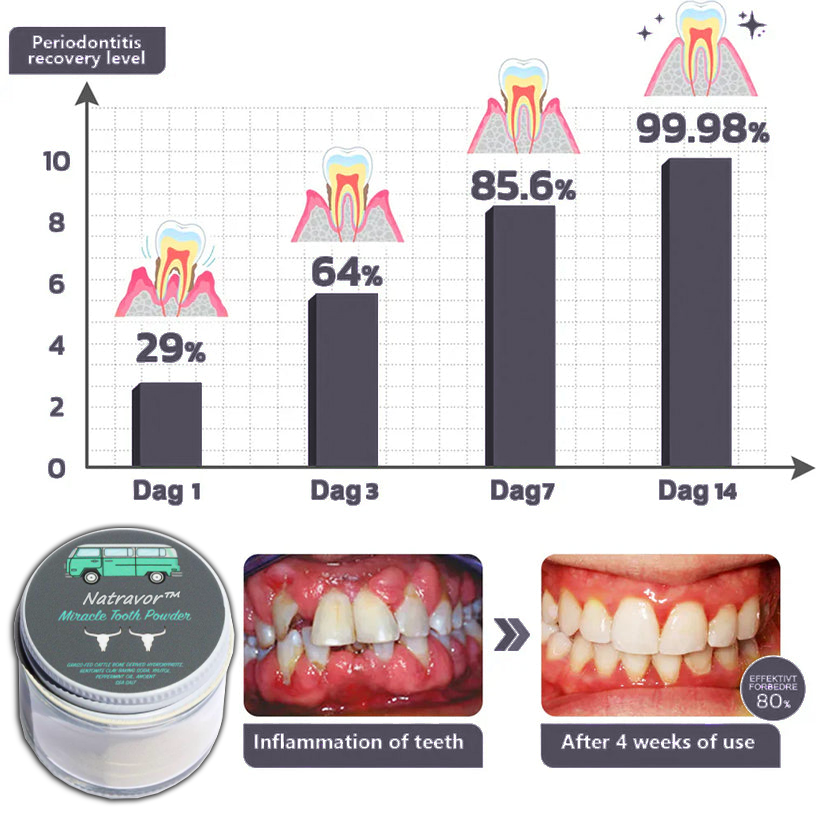 Natravor™Miracle Tooth Powder🦷Obtain American Dental Association (ADA) Certification (Treats periodontitis and mouth ulcers, prevents tooth loss, and repairs gum recession)