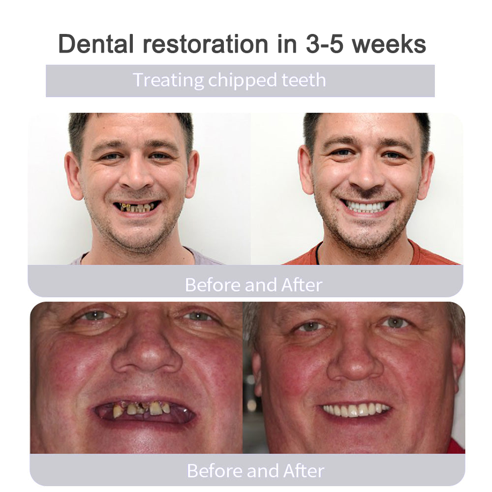 Natravor™Miracle Tooth Powder🦷Obtain American Dental Association (ADA) Certification (Treats periodontitis and mouth ulcers, prevents tooth loss, and repairs gum recession)