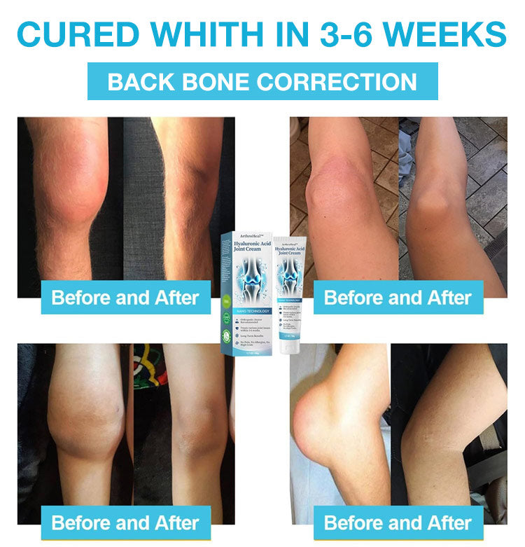 Healthylabcu® Hyaluronic Acid Joint Repair Cream-Experience Soothing Relief and Enhanced Mobility!