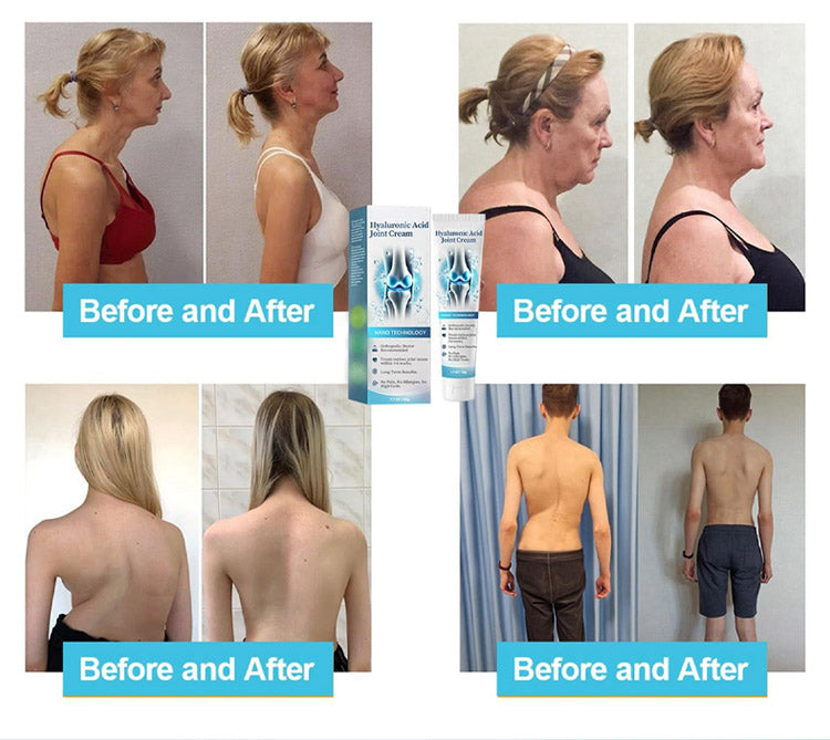 Healthylabcu® Hyaluronic Acid Joint Repair Cream-Experience Soothing Relief and Enhanced Mobility!