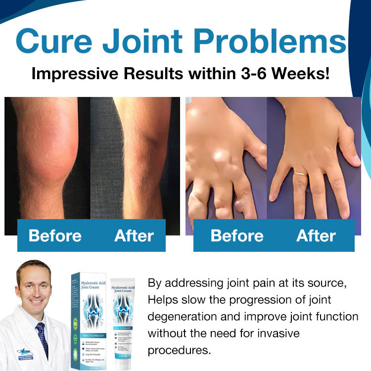 Healthylabcu® Hyaluronic Acid Joint Repair Cream-Experience Soothing Relief and Enhanced Mobility!