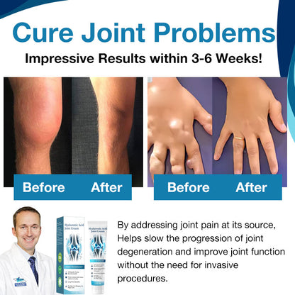 Healthylabcu® Hyaluronic Acid Joint Repair Cream-Experience Soothing Relief and Enhanced Mobility!